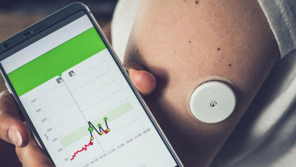 La bomba de insulina inteligente, un dispositivo de gran eficacia para controlar los niveles de glucosa en sangre