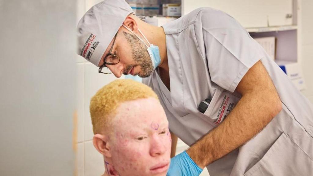 Persona con albinismo atendida por servicios sanitarios