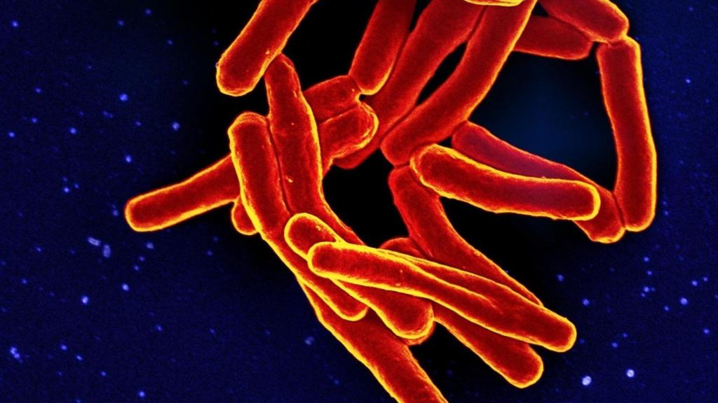 Micrografía electrónica de barrido de partículas de Mycobacterium tuberculosis (coloreadas en rojo y amarillo), la bacteria que causa la tuberculosis