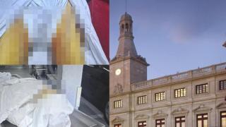Las cicatrices en un cuerpo y el Ayuntamiento de Reus