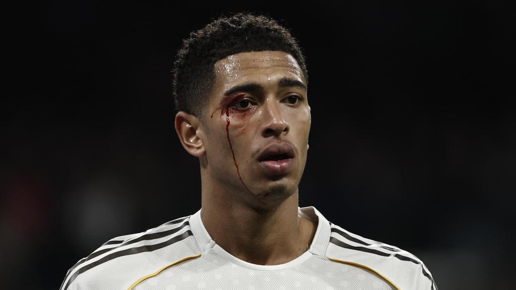 Jude Bellingham sangra del ojo tras un codazo de Borja Iglesias en el Real Madrid-Celta de Vigo
