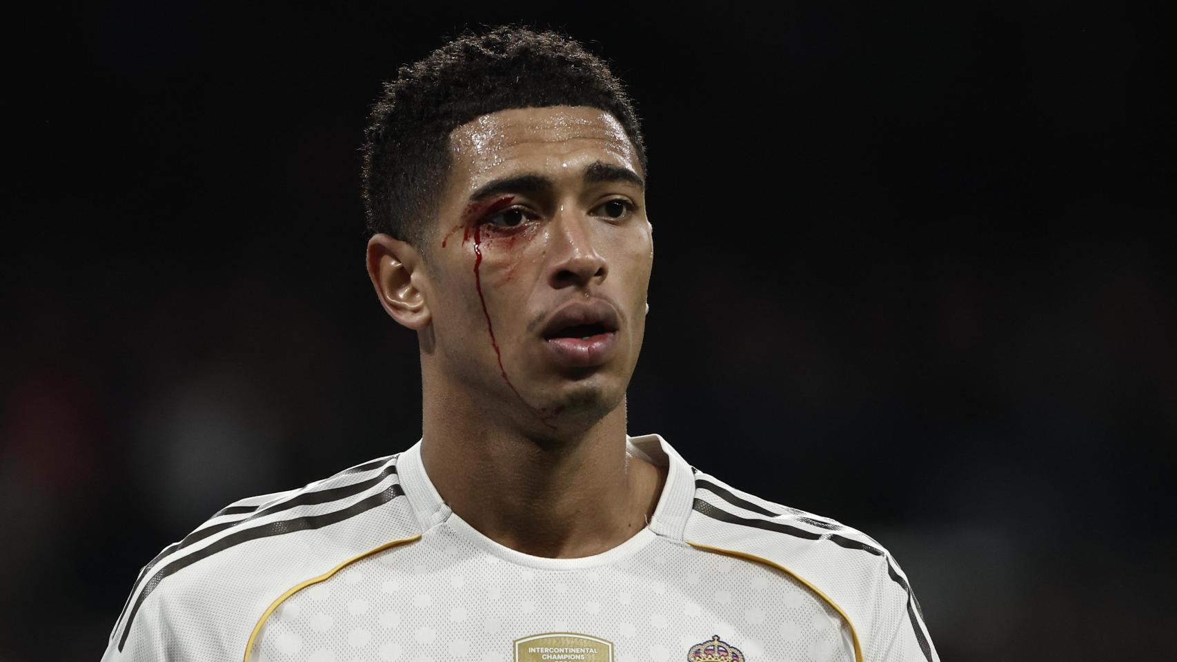 Jude Bellingham sangra del ojo tras un codazo de Borja Iglesias en el Real Madrid-Celta de Vigo