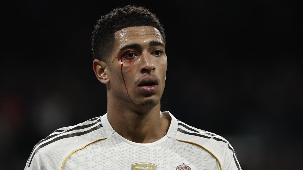 Jude Bellingham sangra del ojo tras un codazo de Borja Iglesias en el Real Madrid-Celta de Vigo