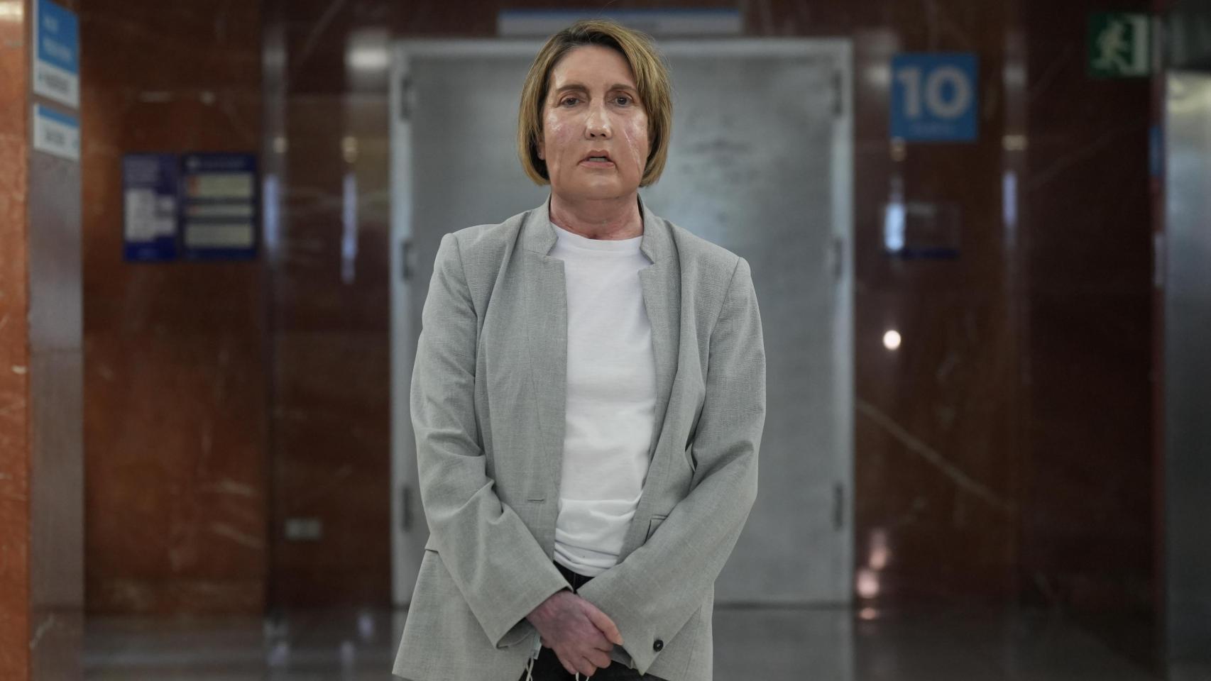 La paciente que recibió el trasplante, en el Hospital Vall d'Hebron, a 2 de febrero de 2026, en Barcelona, Catalunya