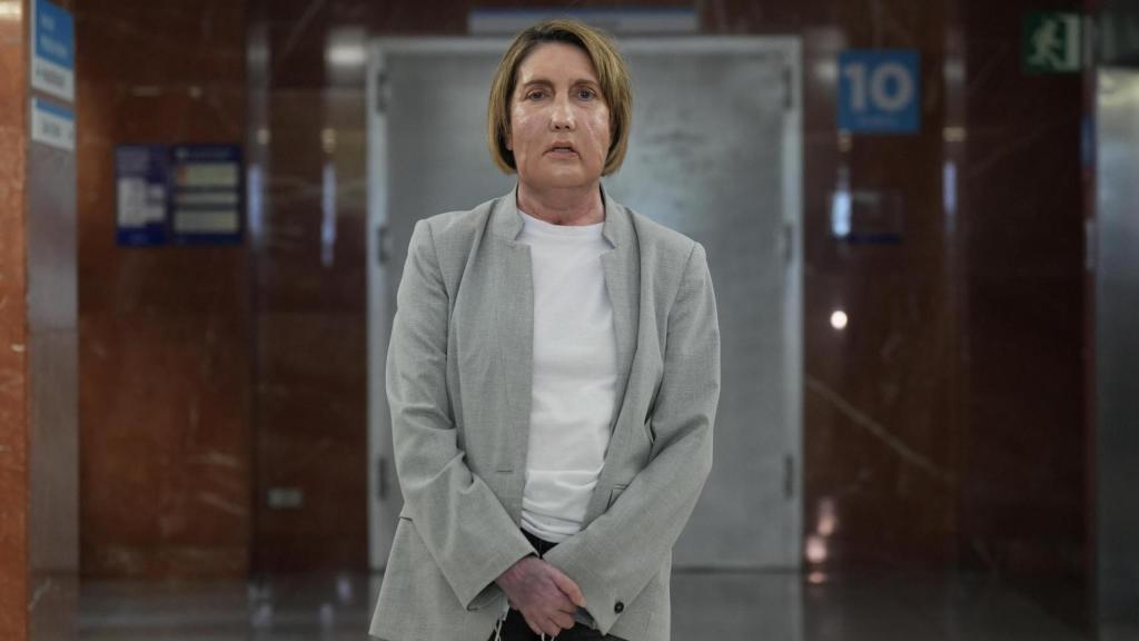 La paciente que recibió el trasplante, en el Hospital Vall d'Hebron, a 2 de febrero de 2026, en Barcelona, Catalunya