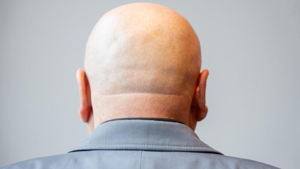 Karl Jacobi, de espaldas, tras negarse a mostrar su rostro ante las cámaras