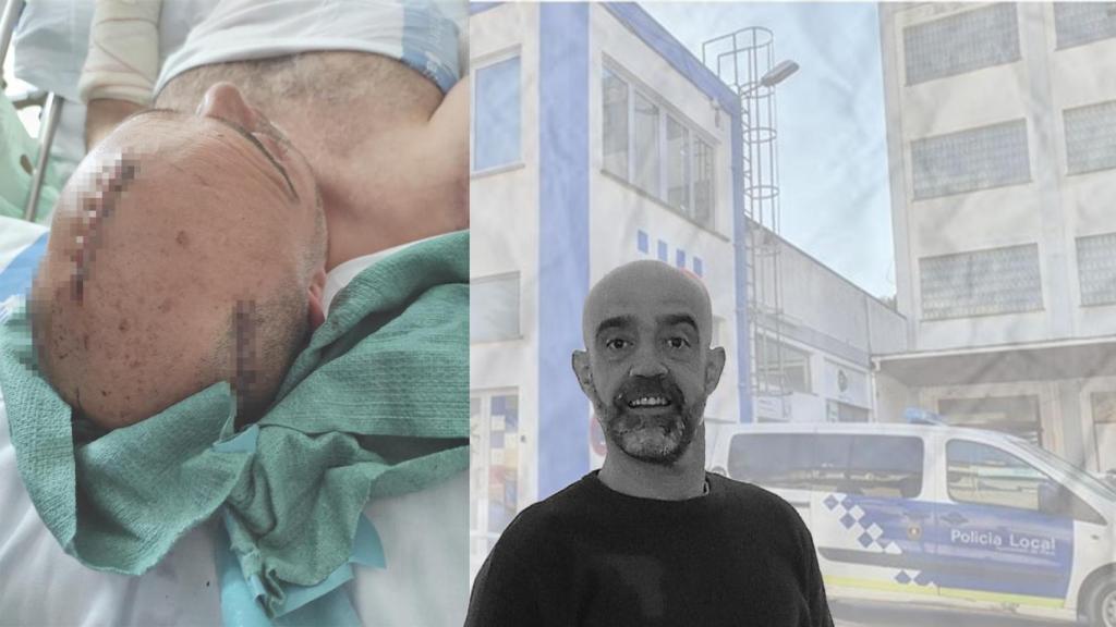 El antes y el después de Javier Berzas: las heridas en el hospital y en la actualidad