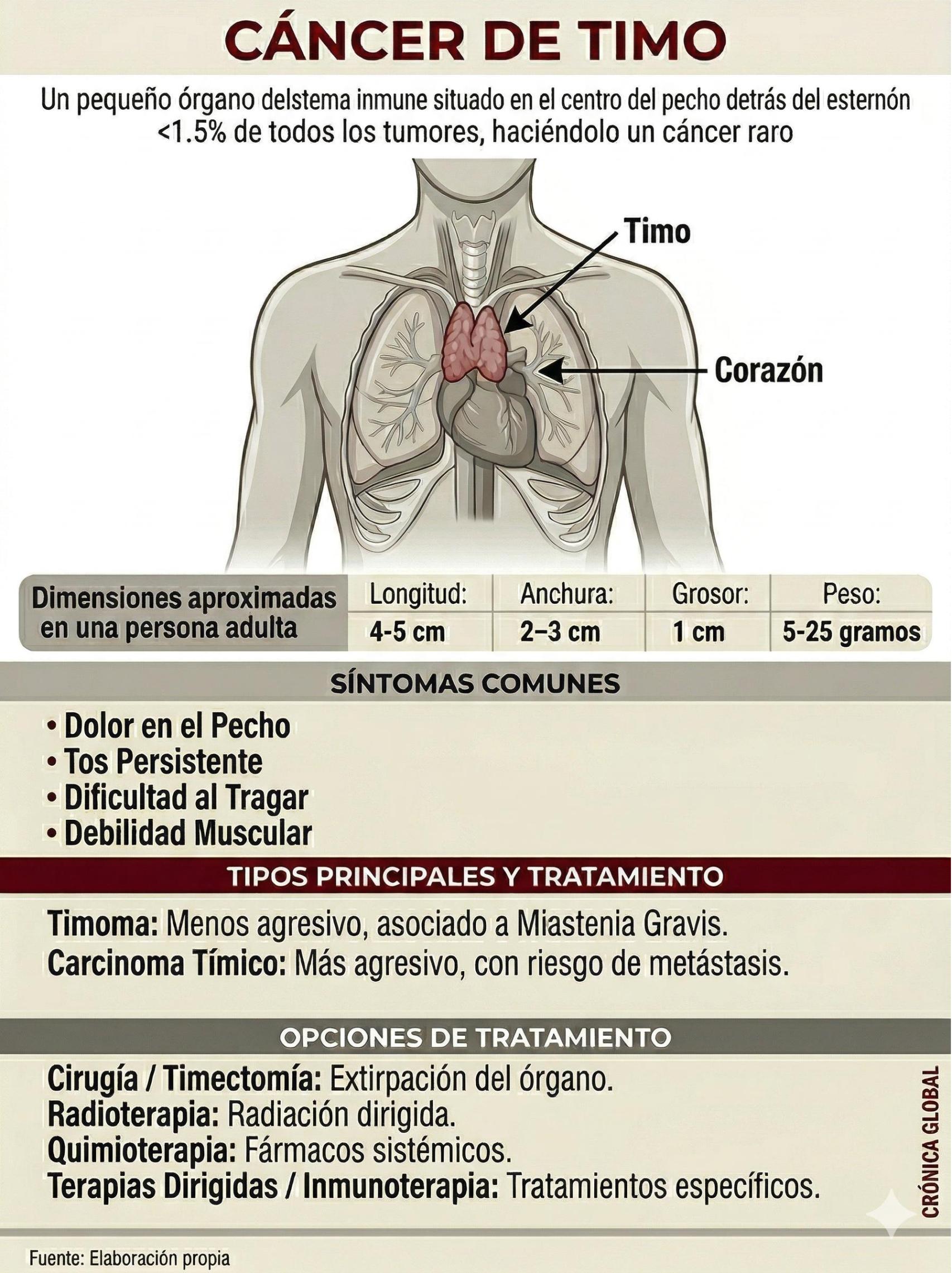 Infografía del cáncer de timo