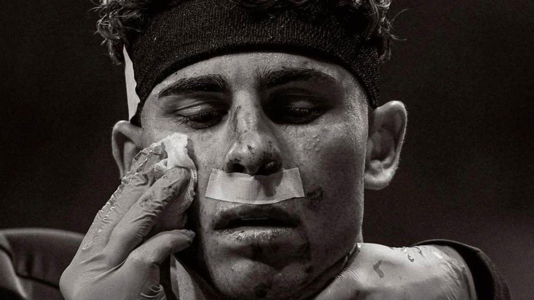 Fermín López sufre un corte en la cara durante el Atlético de Madrid-Barça de la Champions League