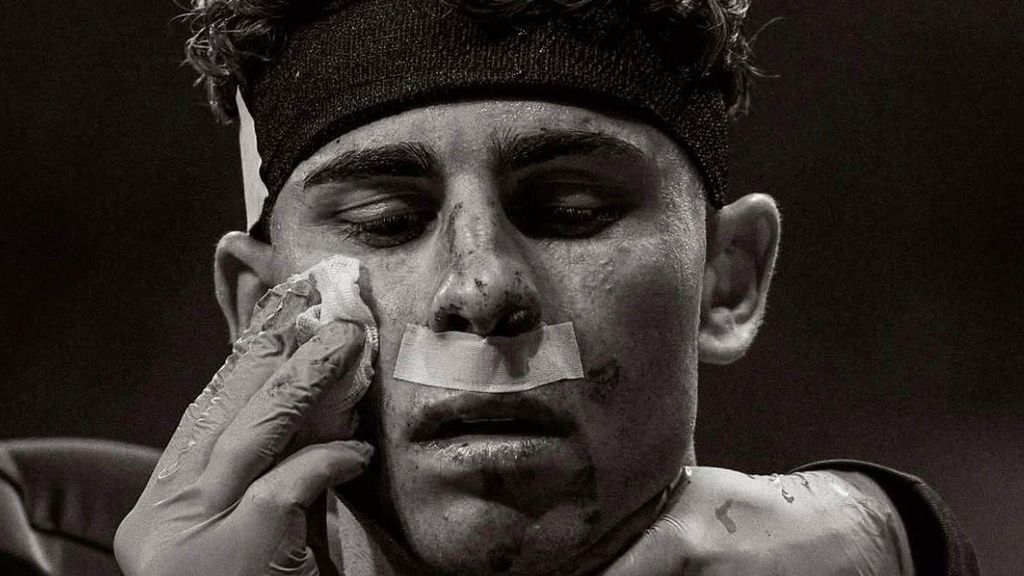 Fermín López sufre un corte en la cara durante el Atlético de Madrid-Barça de la Champions League