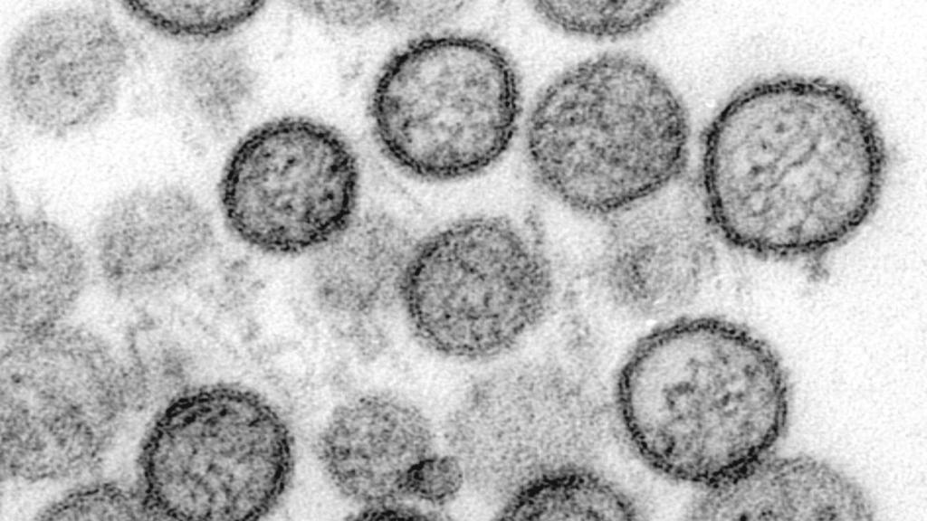 Hantavirus a nivel microscópico