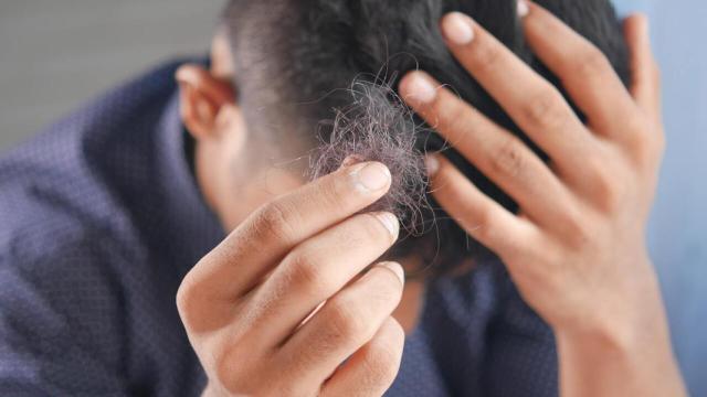 Hombre con caida del cabello