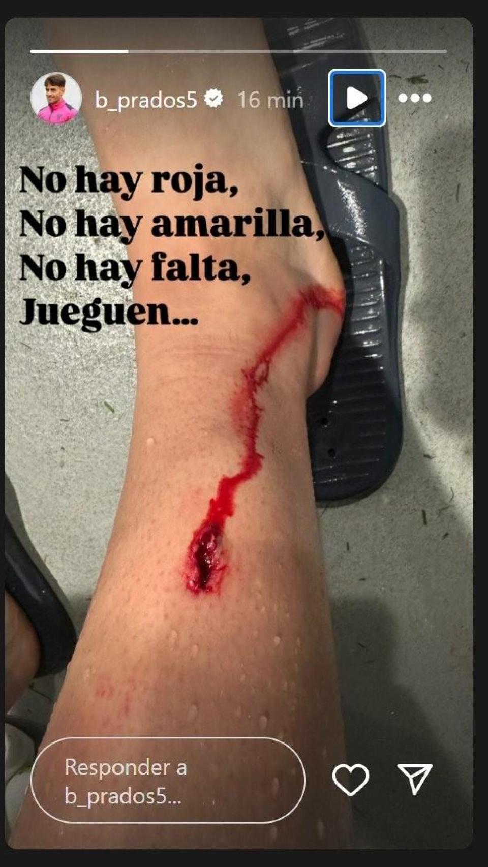 Captura de Instagram de Beñat Prados