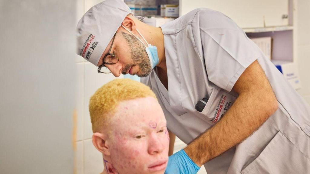 ISDIN y África Directo superan las 5.200 personas con albinismo atendidas en Mozambique contra el cáncer de piel