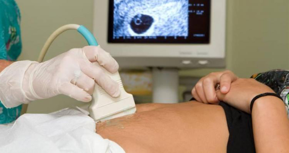 Un profesional realiza una ecografía a una mujer embarazada / EP