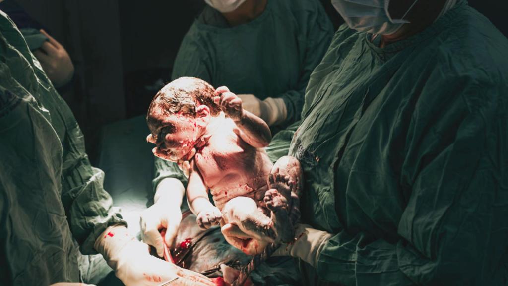 Imagen de un bebé recién nacido en un quirófano / Pexels - Natalia Olivera