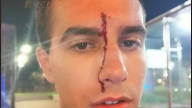 Imagen de la herida ocasionada en la frente tras la agresión homófoba / TWITTER