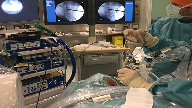 Una imagen del equipo de cirujanos e investigadores del Morgenstern Institute of Spine (MIS) del Centro Médico Teknon durante la intervención