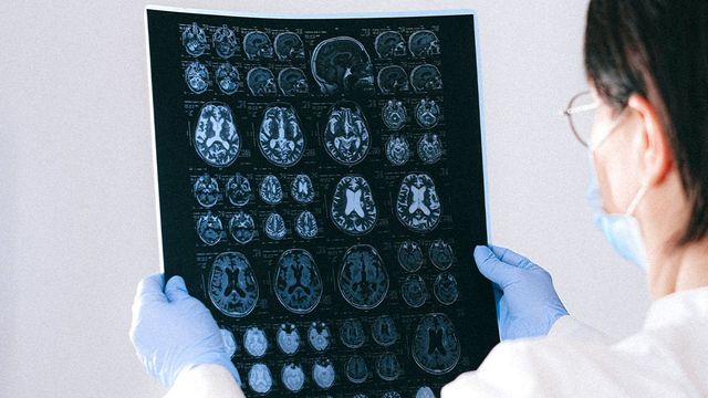 El coronavirus tiene efectos neurobiológicos / ARCHIVO