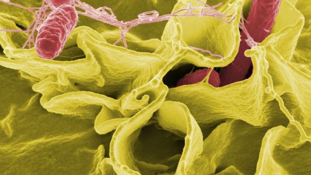 Imagen microscópica de la salmonela / PIXABAY