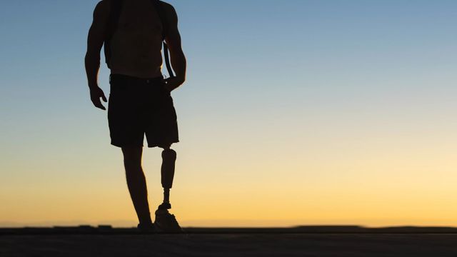 Un hombre camina con una prótesis en una pierna amputada. Los implantes protésicos osteointegrados suponen una gran mejora para los amputados / CEDIDA QUIRÓNSALUD