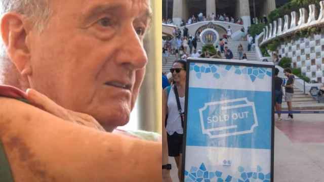 Un vecino del Carmel muestra las heridas que le ha provocado un turista / GALA ESPÍN