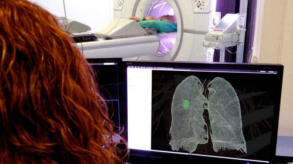 Imatge d'un cribratge de càncer de pulmó