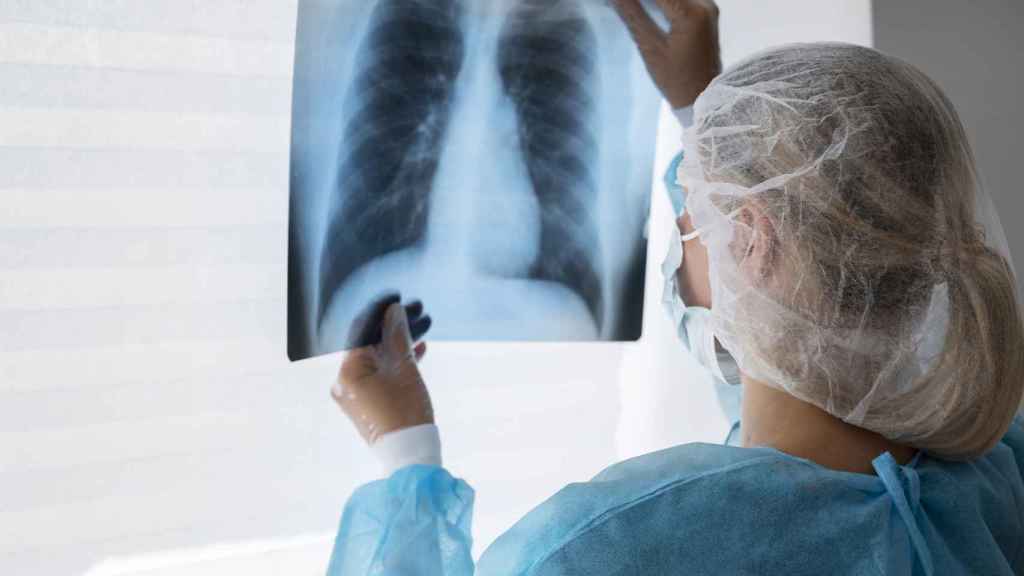 Una especialista examina una radiografia pulmonar