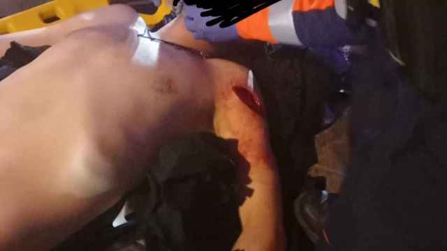 Un miembro de Desokupa, apuñalado en el Raval