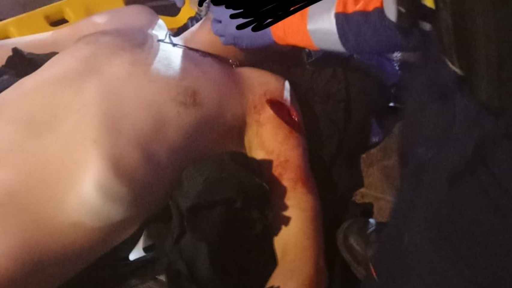Un miembro de Desokupa, apuñalado en el Raval