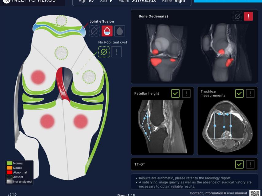 El algoritmo Keros, centrado en rodillas