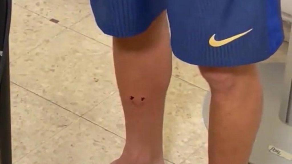 Pierna de Pedri tras la entrada sufrida en el Rayo-Barça