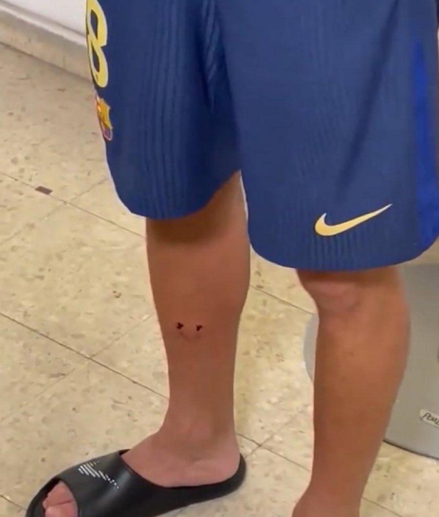 Pierna de Pedri tras la entrada sufrida en el Rayo-Barça