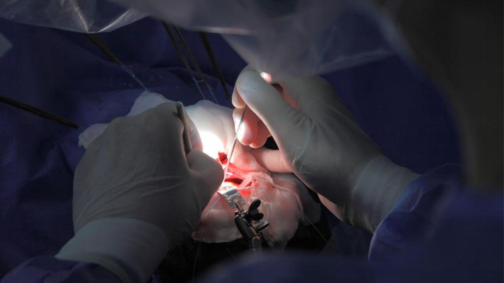 Imatge d'arxiu neurologia