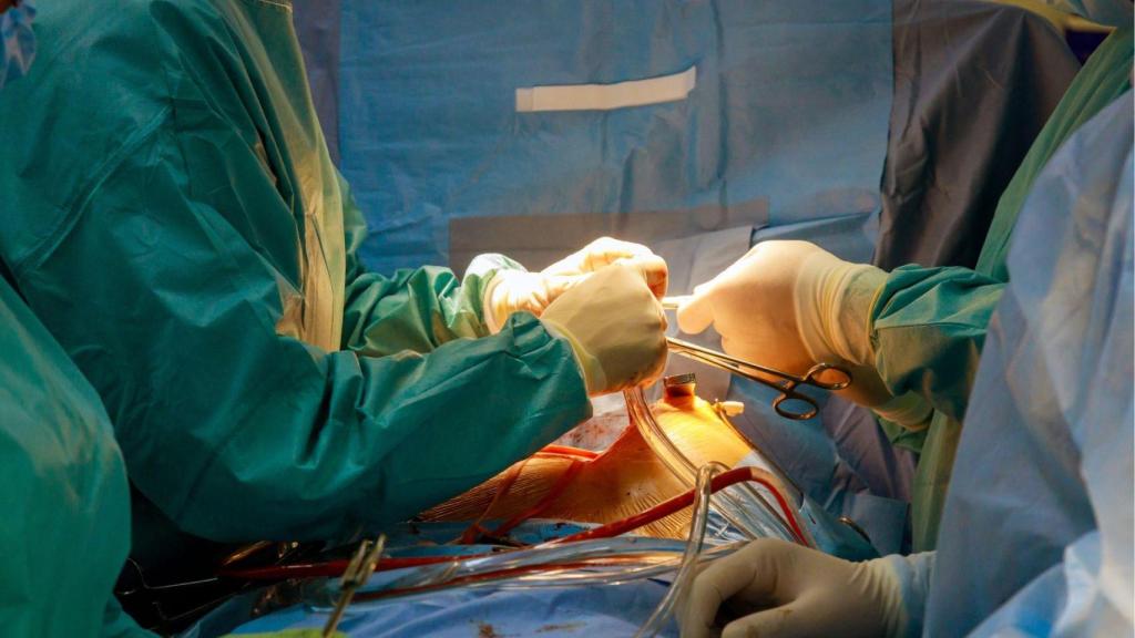 Imagen de archivo operación