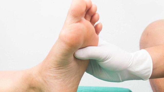 La metatarsalgia se manifiesta en la parte anterior de la planta del pie