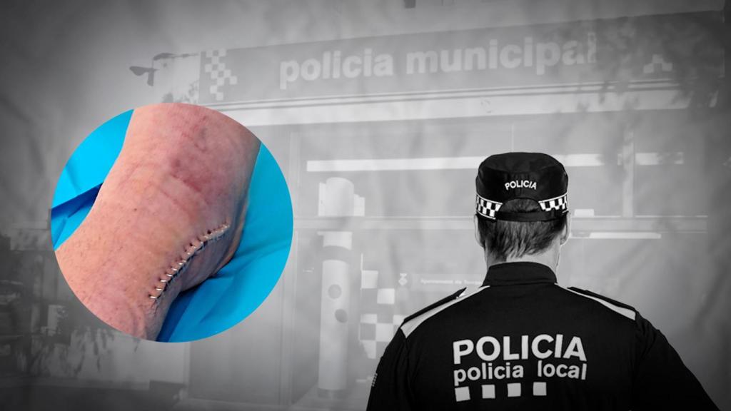 Habla el agente de Terrassa herido en un parking okupado: Mi agresor está libre y quiere matar a un policía