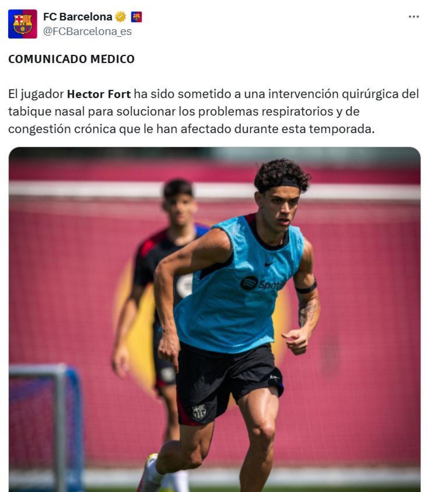 El Barça comunica la operación de Héctor Fort para tratarse de sus problemas respiratorios