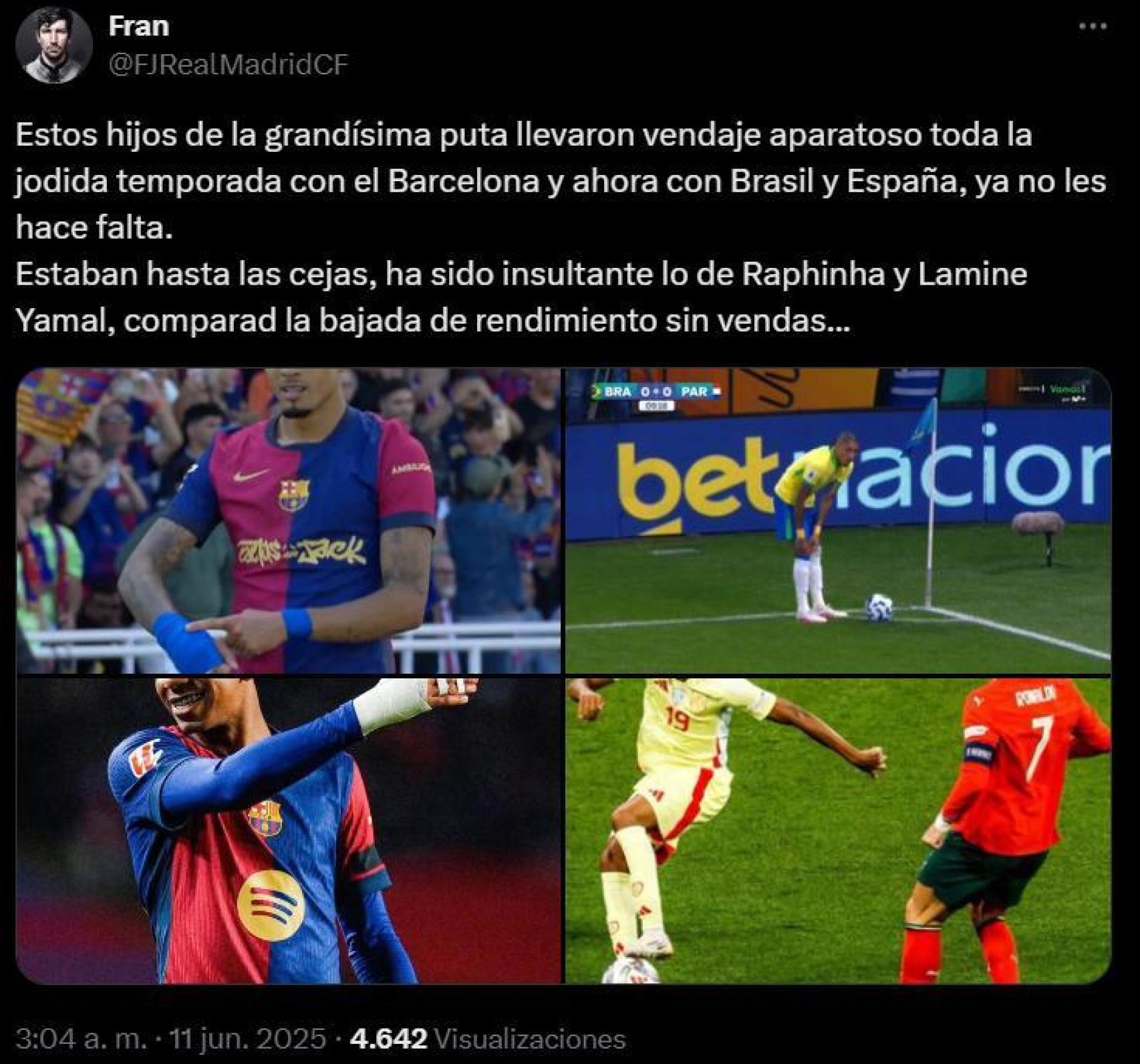 Publicación en Twitter de un usuario madridista que insinúa una supuesta práctica irregular por los vendajes de los jugadores del Barça (1)