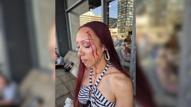 Adriana, víctima de una agresión por parte de unos carteristas en la estación de Sants