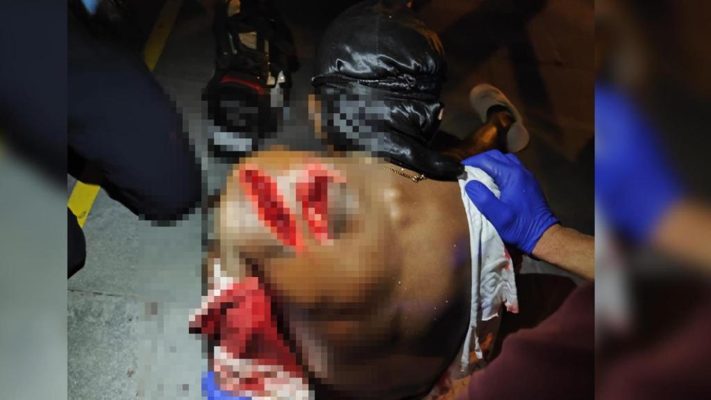 Fotografía de uno de los heridos tras el brutal enfrentamiento entre bandas latinas en Nou Barris