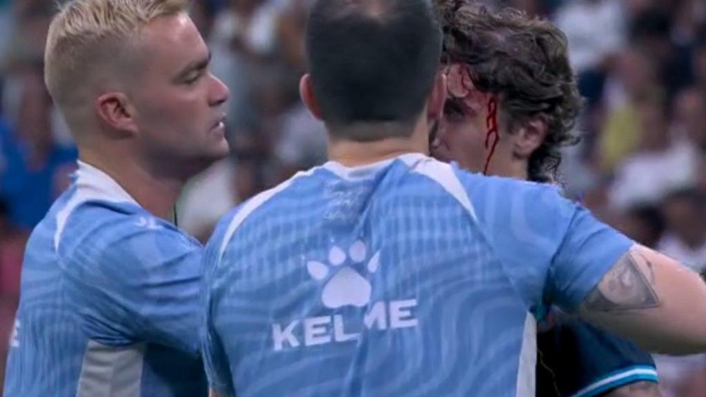 Carlos Romero, atendido con una brecha en la cabeza durante el Real Madrid-RCD Espanyol