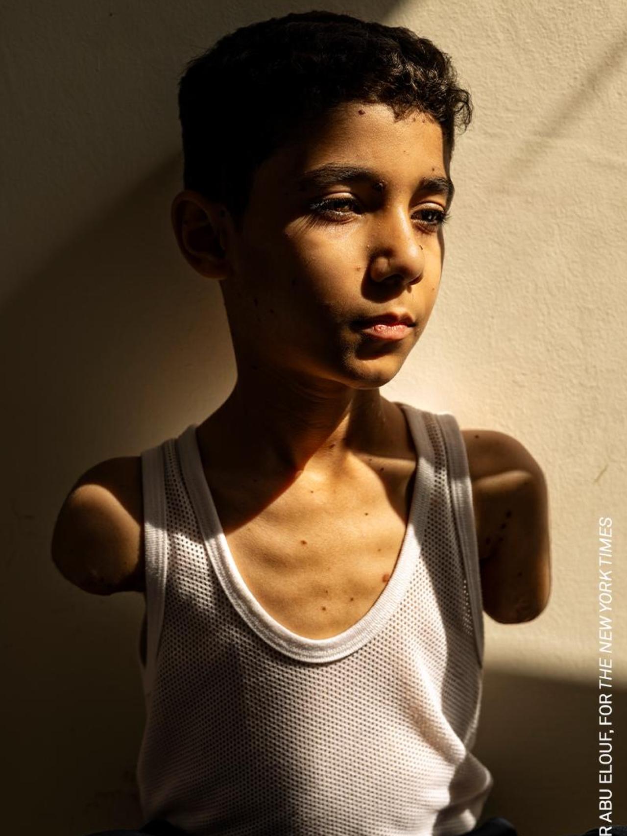 Mahmoud Ajjour (9), que va resultar ferit durant un atac israelià a la Ciutat de Gaza el març de 2024, ha trobat refugi i ajuda mèdica a Qatar. Doha, Qatar, 28 de juny de 2024.