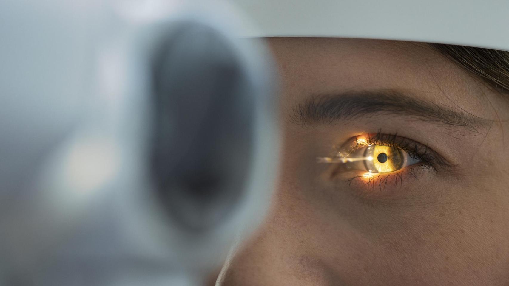 Láser para controlar el glaucoma sin cirugía