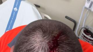 Víctima de la agresión en el metro de Barcelona el sábado 22 de noviembre