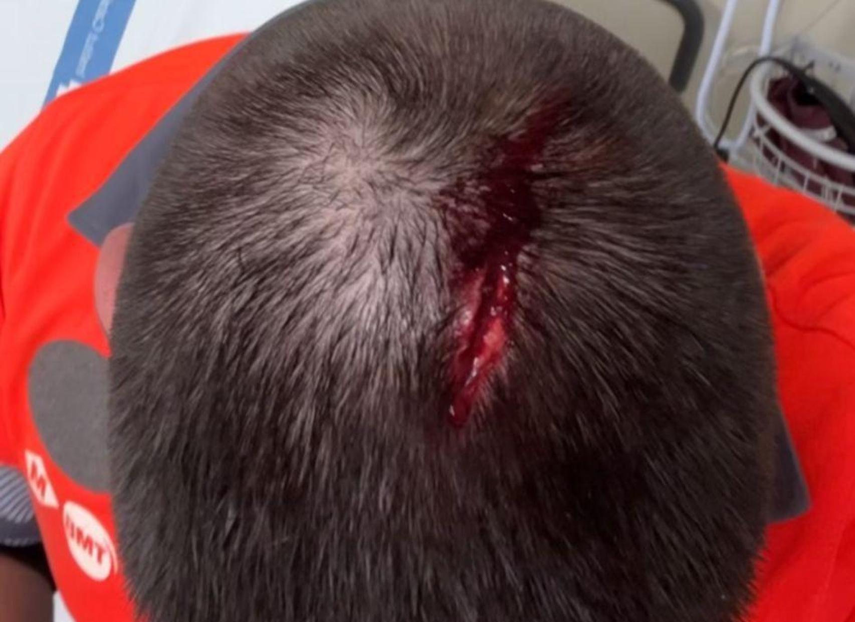 Víctima de l'agressió al metro de Barcelona el dissabte 22 de novembre