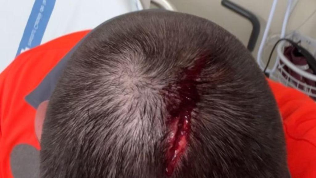 Víctima de l'agressió al metro de Barcelona el dissabte 22 de novembre