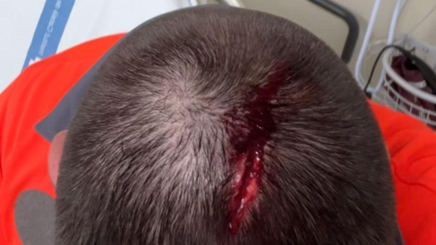 Víctima de la agresión en el metro de Barcelona el sábado 22 de noviembre