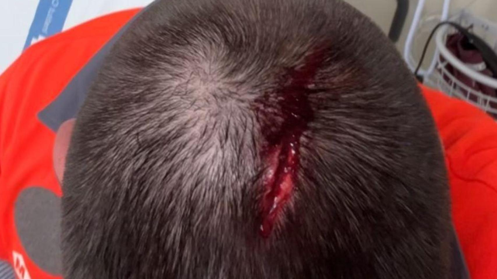 Víctima de la agresión en el metro de Barcelona el sábado 22 de noviembre