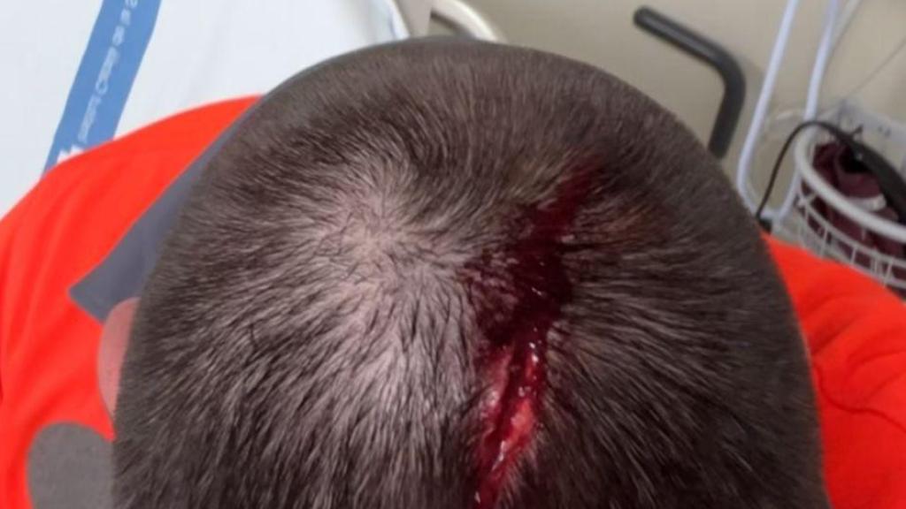 Víctima de la agresión en el metro de Barcelona el sábado 22 de noviembre